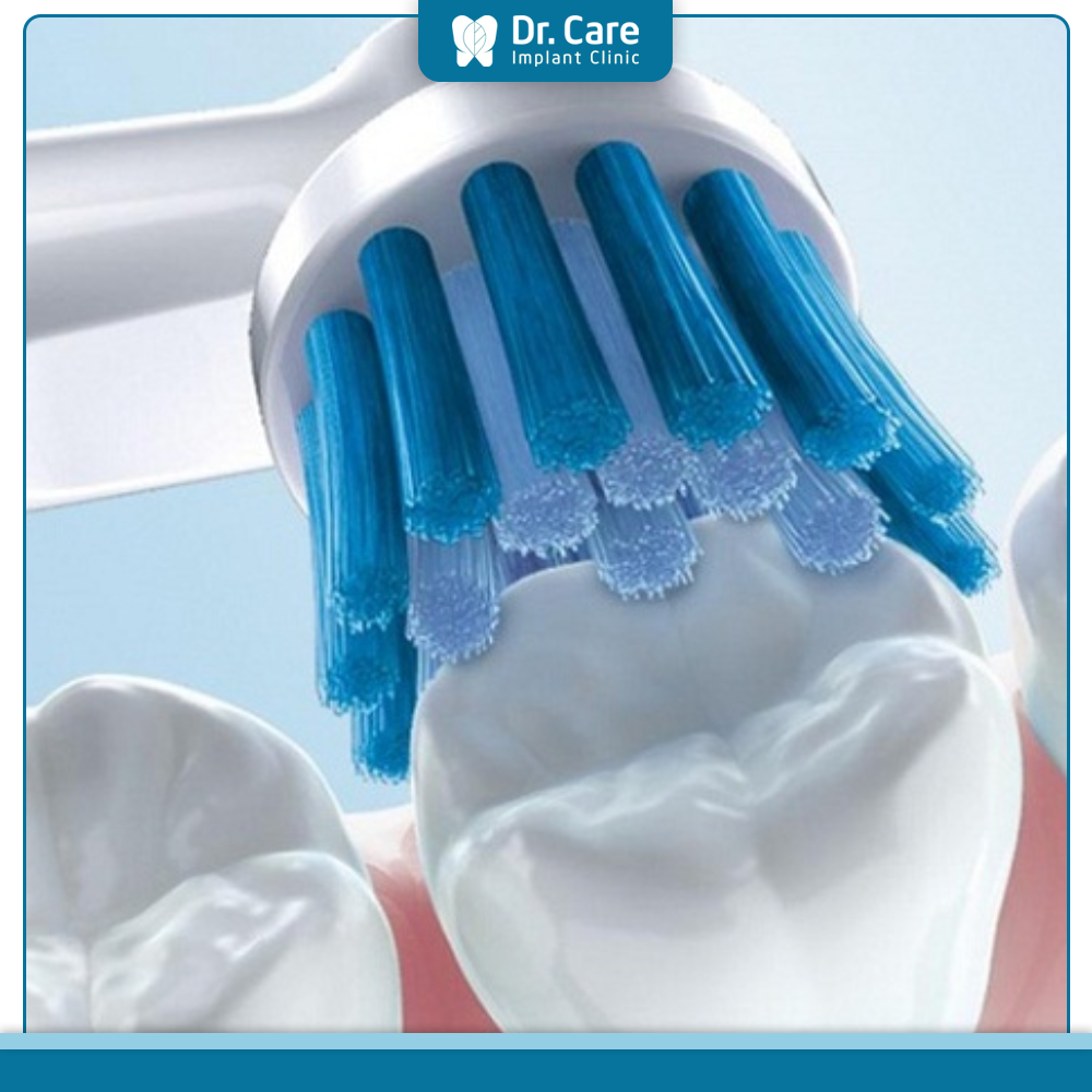 Các biện pháp tốt nhất để phòng tránh tủy răng bị viêm